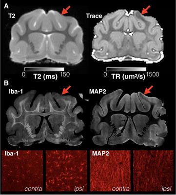 Frontiers detection and distinction of mild brain injury effects in a